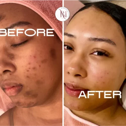 before-after-marrom-beauty